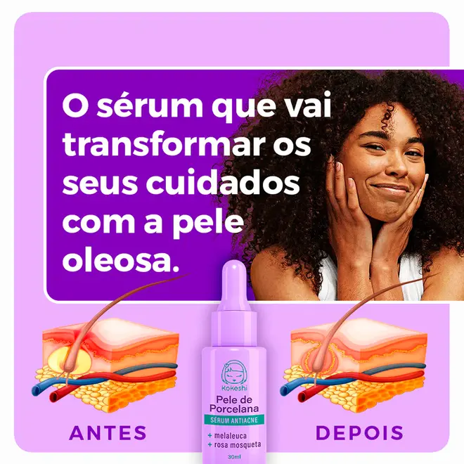Sérum Facial Antiacne Kokeshi Pele de Porcelana Antisséptica 30ml