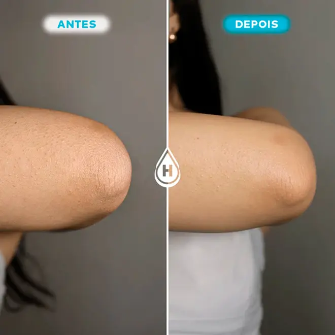 Loção Hidratante Corporal Hidratei 200ml